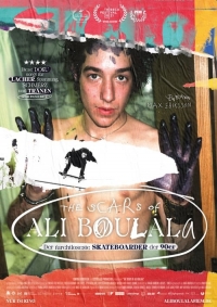 The Scars of Ali Boulala The Scars of Ali Boulala